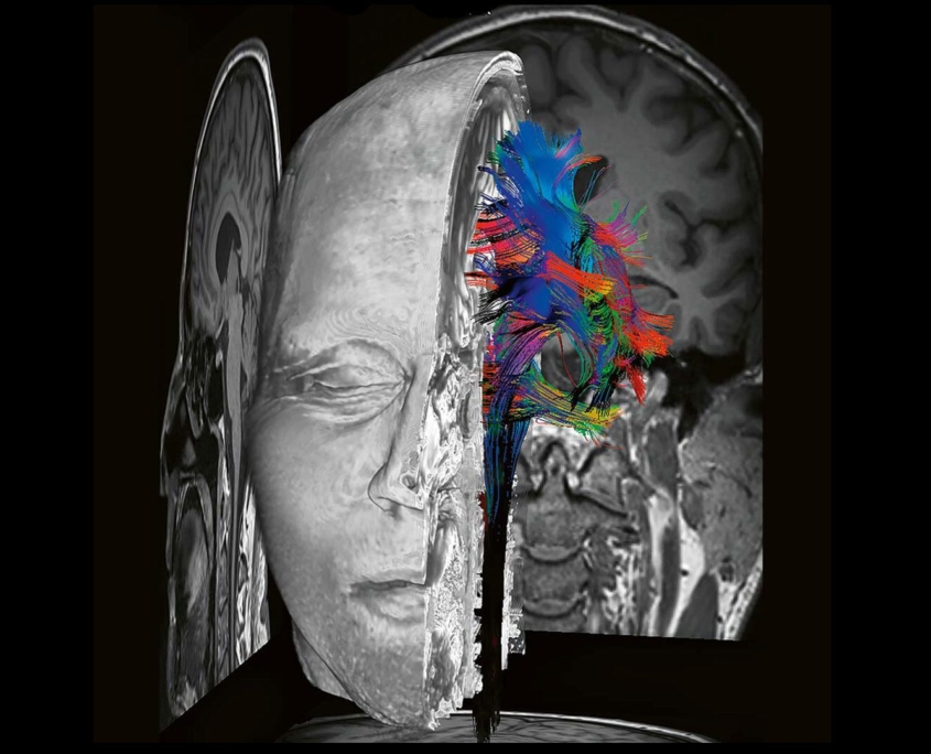 Siemens Healthineers MRI